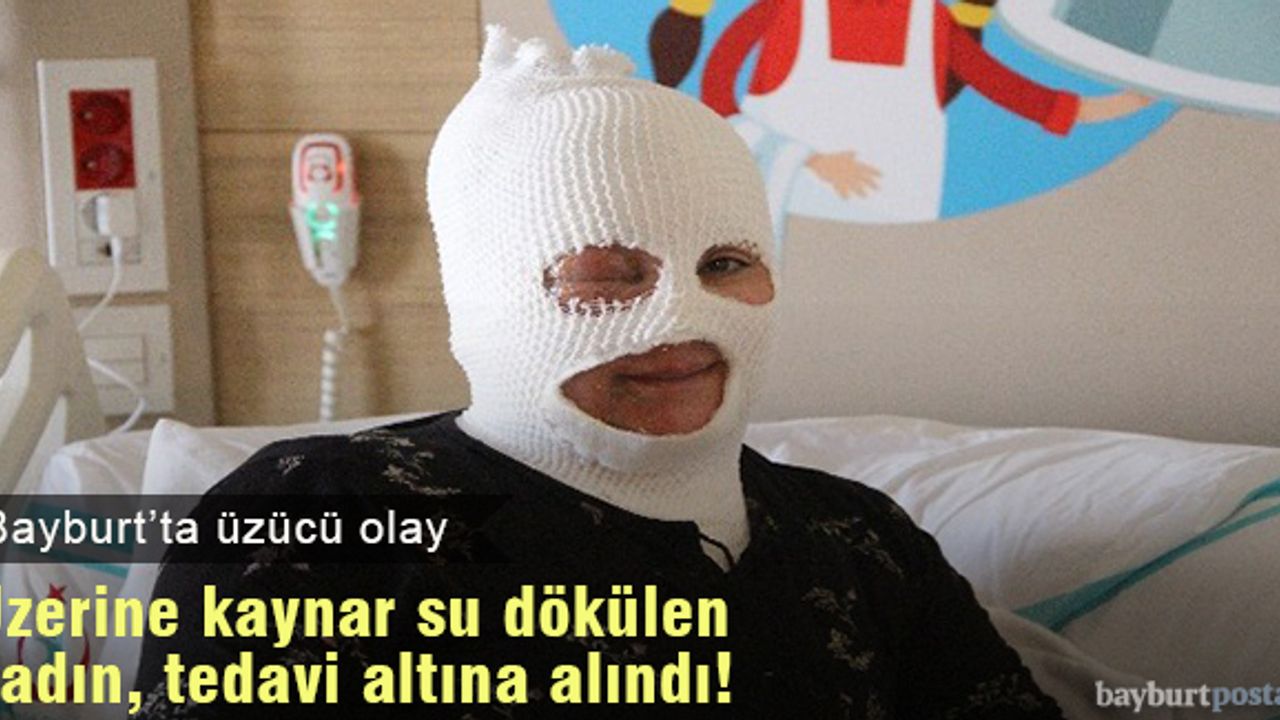 Üzerine kaynar su dökülen kadın hastanelik oldu!