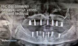 Bayburt'ta dişsiz hastaya umut veren implant tedavisi