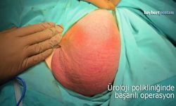 Bayburt'ta Üroloji Polikliniğinde Başarılı Operasyon