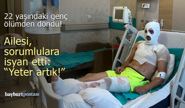 Bayburt'ta korkunç olay: Elektrik akımına kapıldı, ölümden döndü!