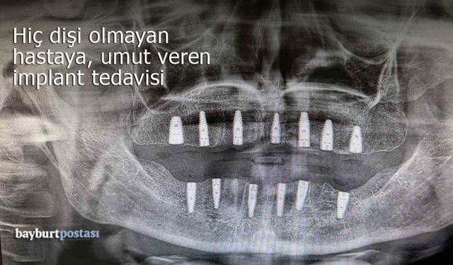 Bayburt'ta dişsiz hastaya umut veren implant tedavisi