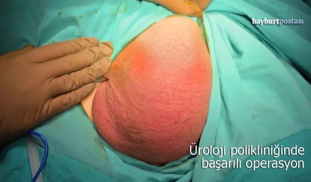 Bayburt'ta Üroloji Polikliniğinde Başarılı Operasyon