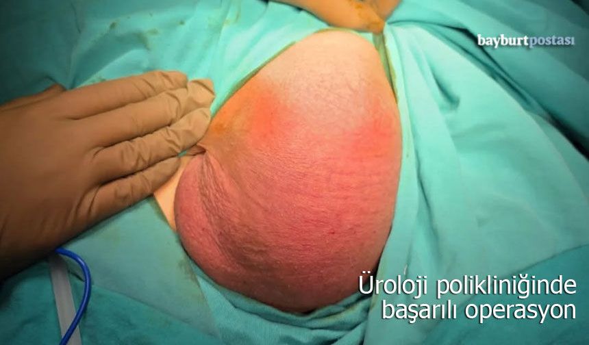 Bayburt'ta Üroloji Polikliniğinde Başarılı Operasyon