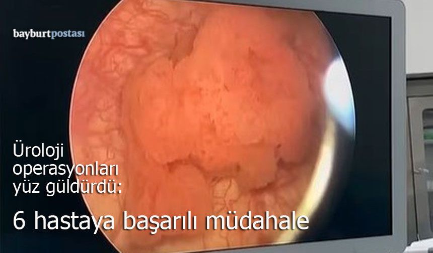 Bayburt'ta Üroloji operasyonları yüz güldürdü: 6 hastaya başarılı müdahale